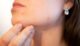 Best Natural Skin Care Methods Steps Tips to Combat Rosacea Help 2021 Image