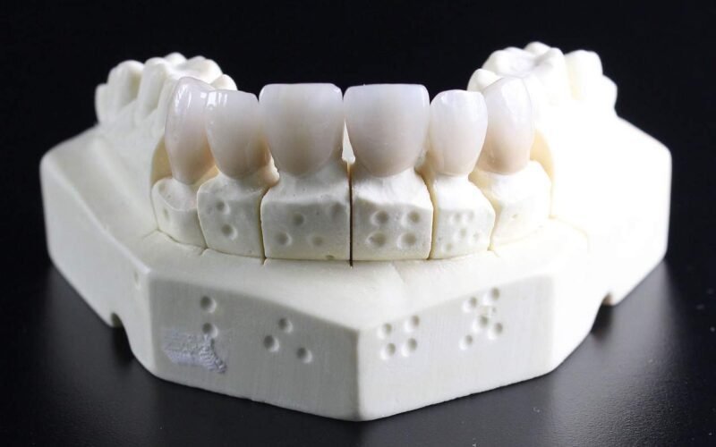 Differences between Temporary Teeth and Permanent Teeth Image